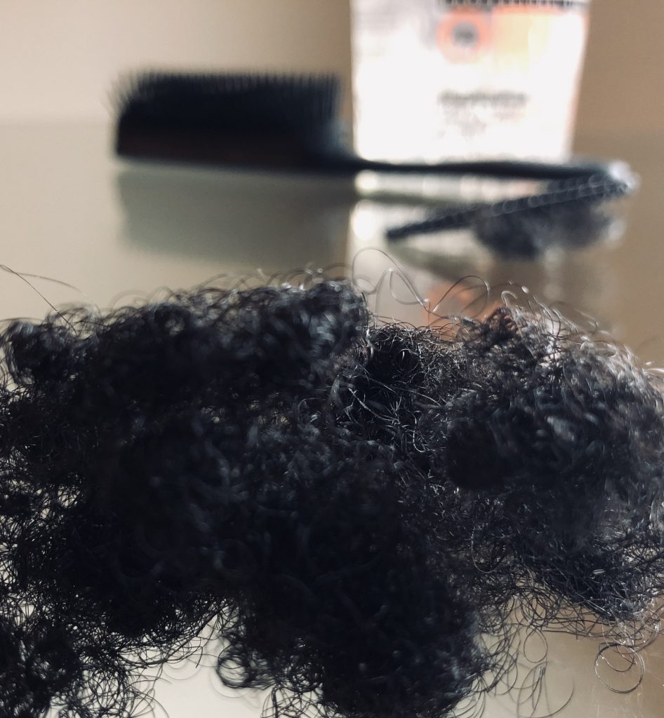 Let’s Talk About Hair Loss (Alopecia)